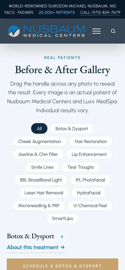 The gallery on a phone.
